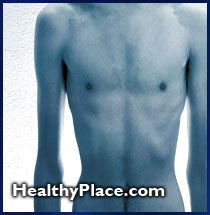 Boys and men get anorexia nervosa and bulimia nervosa. Find here what eating disorders do they get, what are the risk factors, and the treatment of males with eating disorders such as anorexia, bulimia, and binge eating.