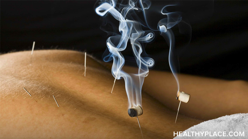 Covers alternative addiction treatments such as acupuncture, hypnotherapy and ibogaine to treat addiction.
