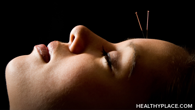 NIH panel concludes the effectiveness of acupuncture in managing chronic pain, fibromyalgia and other conditions is still up in the air.