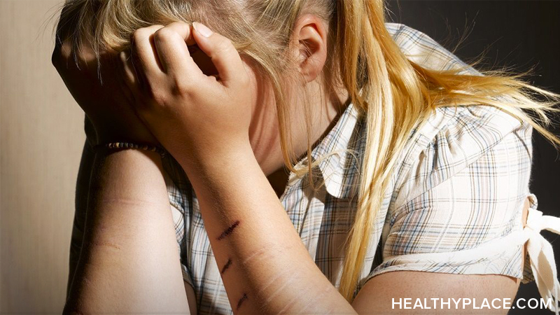 When telling someone you self-injure, self-harm, there are many things to take into consideration. So how do you tell someone you self-injure? Find out here.