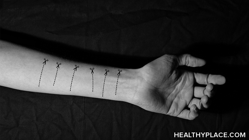 People who hide their self-harm scars feel guilt and shame. It doesn’t have to be this way though. Learn how to talk about self-injury scars.