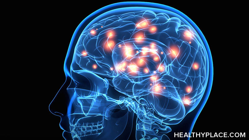 How is the Parkinson’s disease brain different? Find out how Parkinson’s affects the brain and what shows up on a brain scan, here at HealthyPlace. 