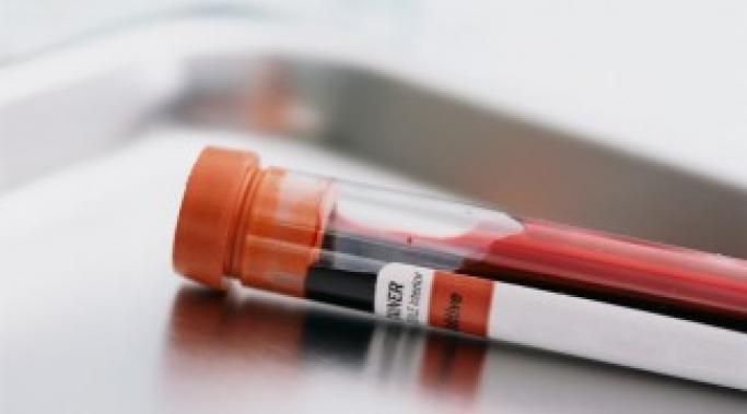 Recently a blood test was heralded for predicting increased suicide risk but can we really predict suicide risk with a simple blood test?