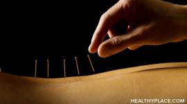 Overview of acupuncture as a natural treatment for depression and whether acupuncture works in treating depression.