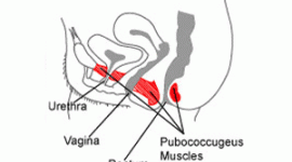 Female pelvic area